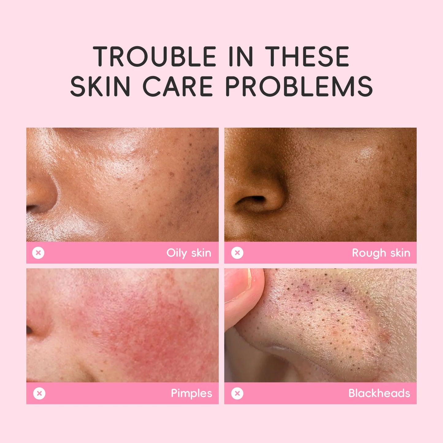 Sakura Mud Facial Mask Tablets - 5/10 PCS Pore Treatment