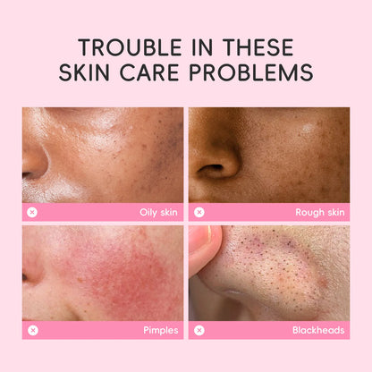 Sakura Mud Facial Mask Tablets - 5/10 PCS Pore Treatment