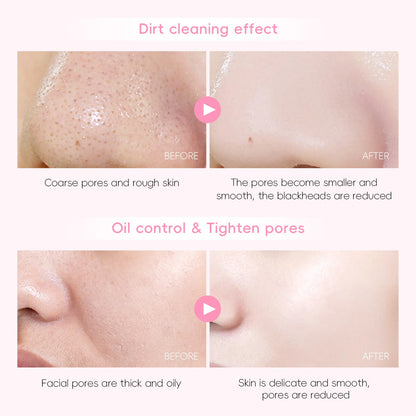 Sakura Mud Facial Mask Tablets - 5/10 PCS Pore Treatment