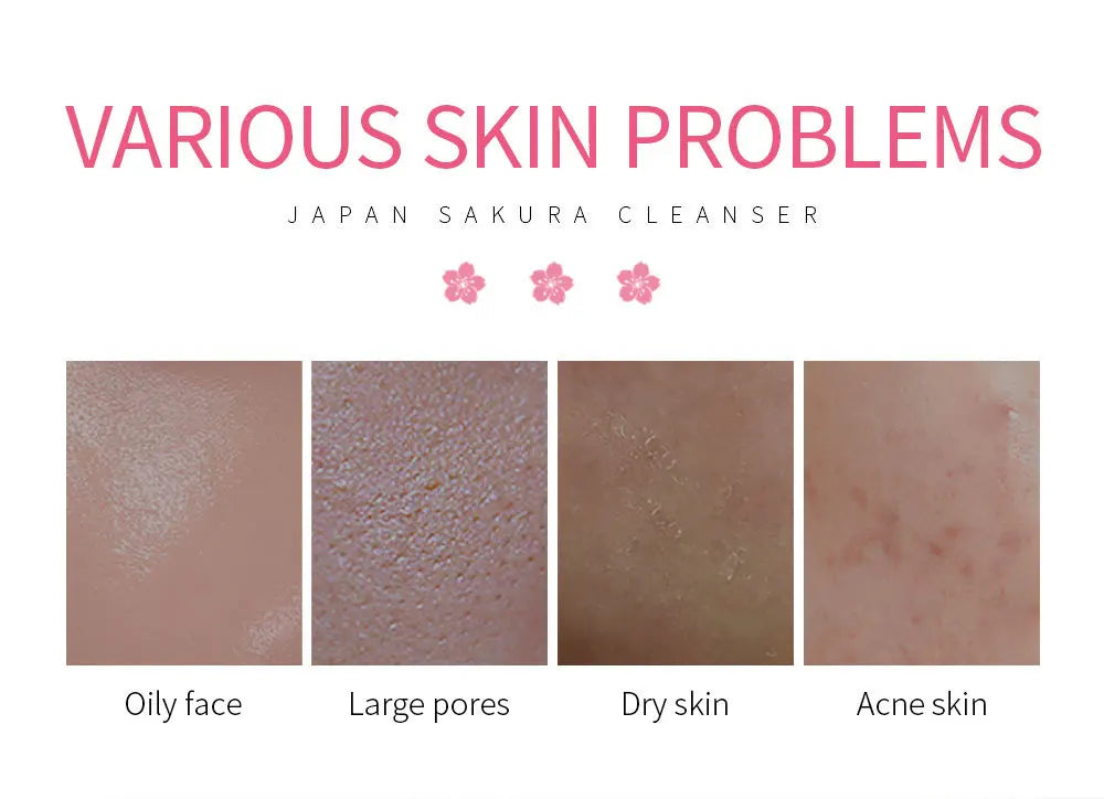 LAIKOU Foaming Face Cleanser - Deep Cleansing Wash