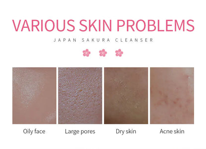 LAIKOU Foaming Face Cleanser - Deep Cleansing Wash